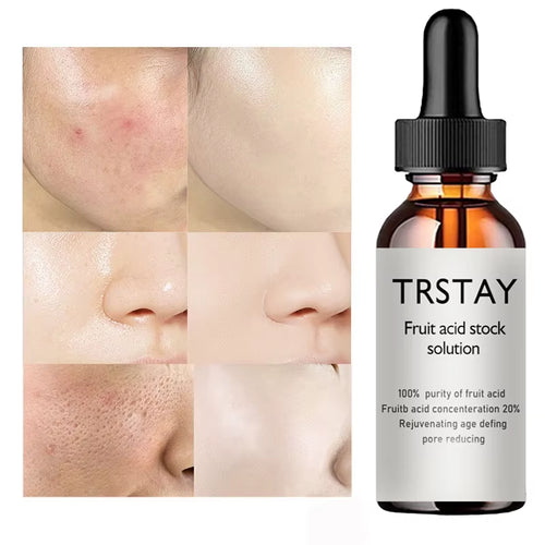 20% Glycolic Acid Oil Liquid anti Wrinkles Face Cream Whitening Skin Care Anti-Aging Serum Skin Care Products